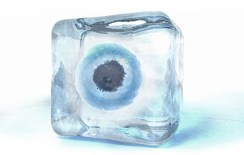 Водянка яичка: причины и лечение гидроцеле Водянка яичка: причины и лечение гидроцеле