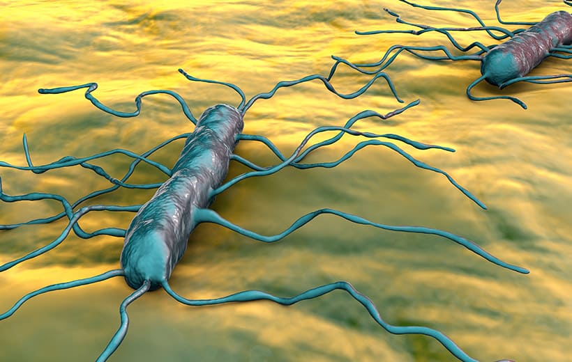 Листериоз: возбудитель, симптомы, лечение