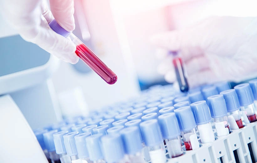 Агранулоцитоз: симптомы и лечение Агранулоцитоз: симптомы и лечение