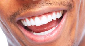 Что такое протезирование зубов и когда оно может стать необходимостью