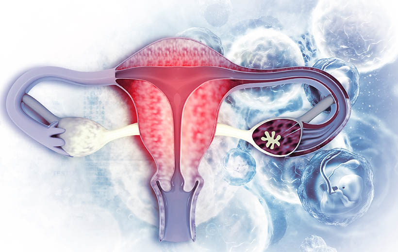 Сальпингит: симптомы и лечение