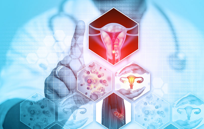 Серозометра: симптомы и лечение