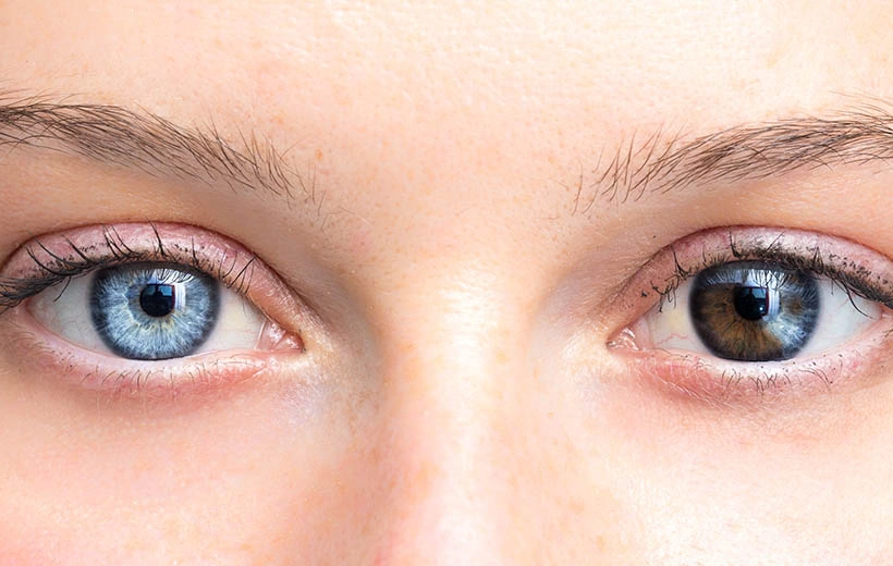 Анизокория: причины, симптомы, лечение