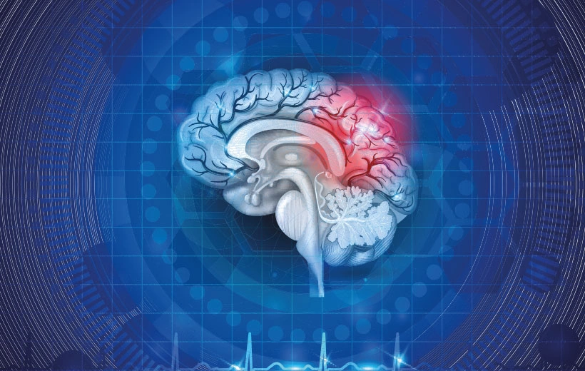 Астроцитома: симптомы, лечение, прогноз Астроцитома: симптомы, лечение, прогноз