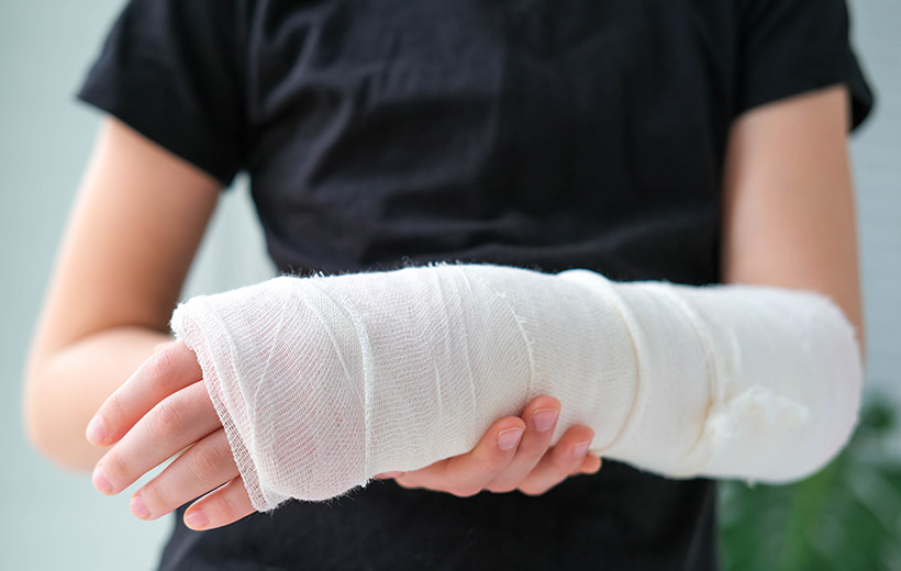 Перелом руки: симптомы, первая помощь, лечение