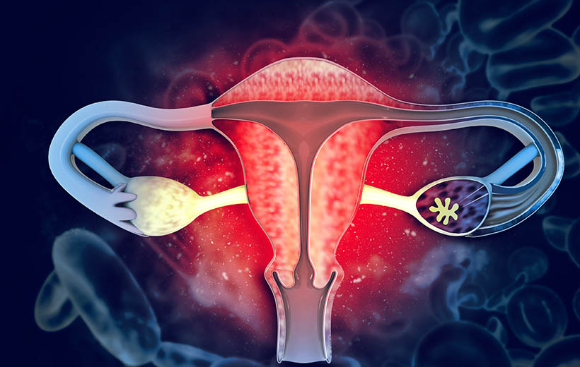 Непроходимость маточных труб: причины, симптомы, лечение Непроходимость маточных труб: причины, симптомы, лечение