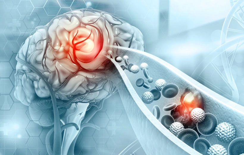 Гранулематоз Вегенера: диагностика и лечение Гранулематоз Вегенера: диагностика и лечение