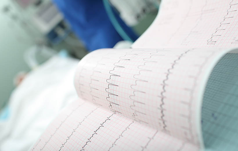 Острый коронарный синдром: причины, симптомы, лечение Острый коронарный синдром: причины, симптомы, лечение