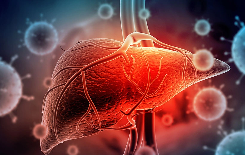 Киста печени: причины, симптомы, лечение Киста печени: причины, симптомы, лечение