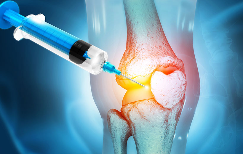 Фибромиалгия: симптомы и лечение Фибромиалгия: симптомы и лечение