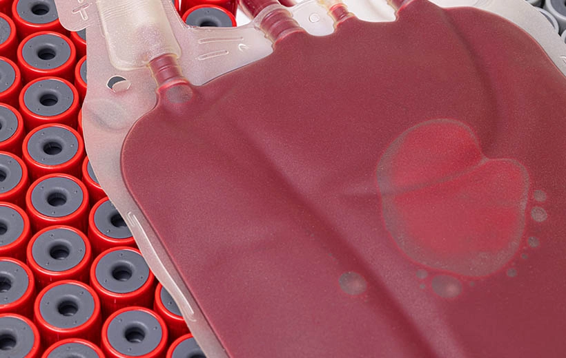 Полицитемия: причины, симптомы, лечение