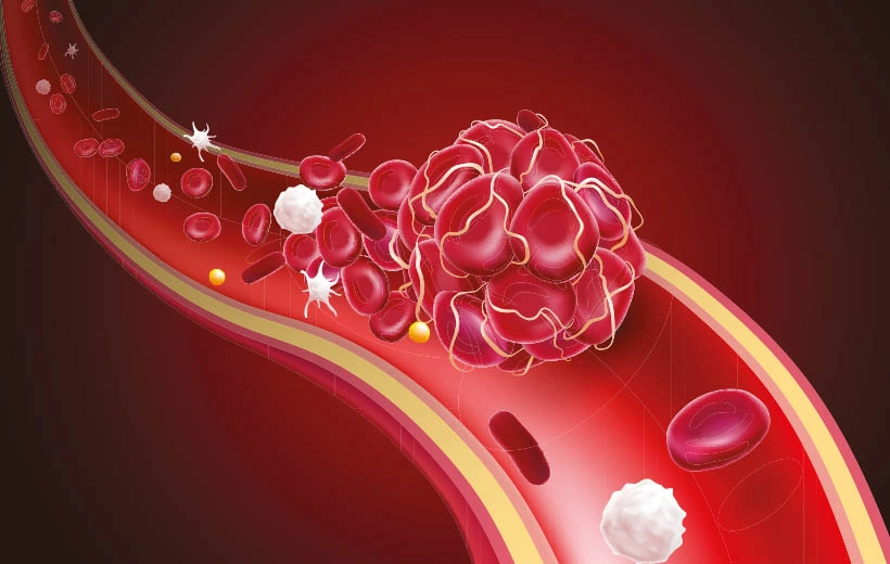 Талассемия: симптомы, диагностика, лечение