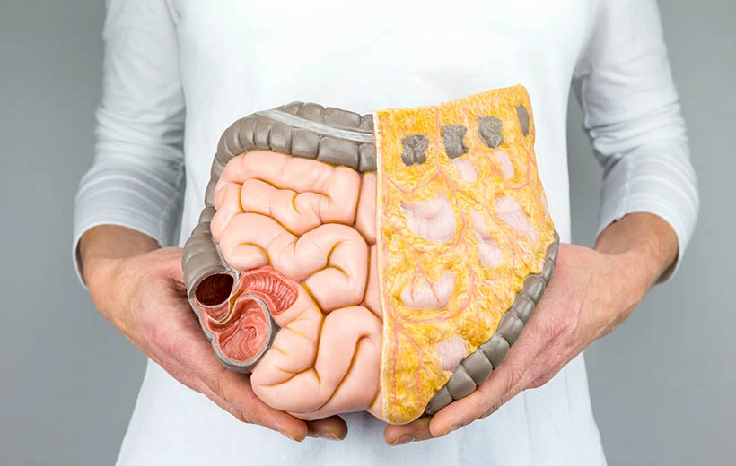 Рак толстой кишки: стадии, симптомы, лечение