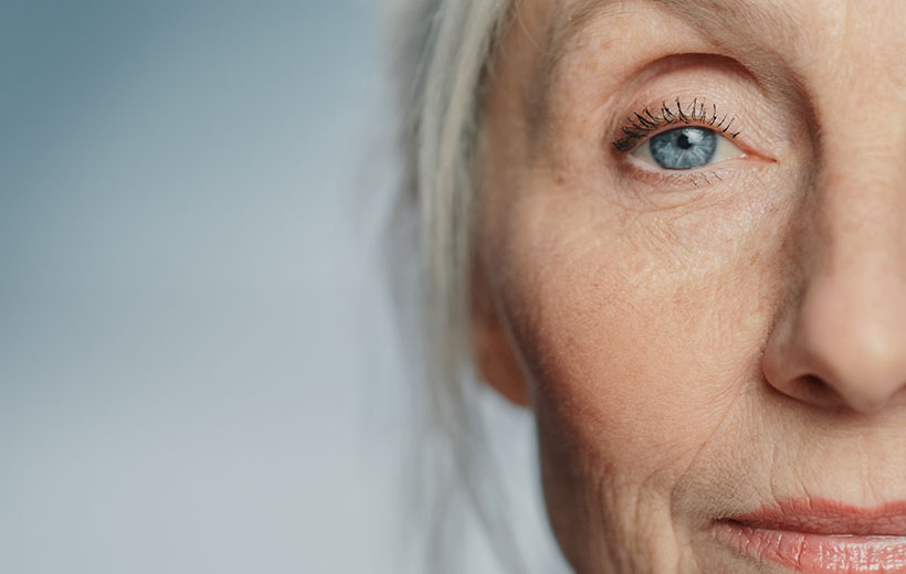 Лагофтальм: причины, симптомы, лечение Лагофтальм: причины, симптомы, лечение