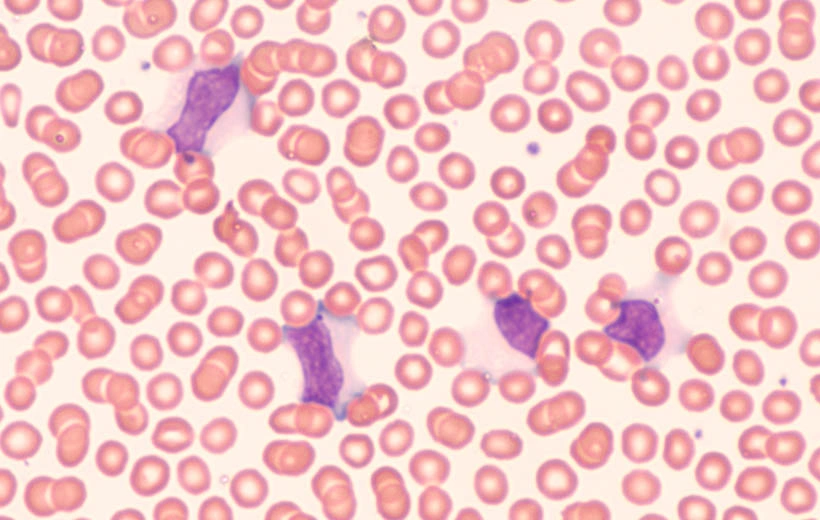 Вирус Эпштейна &ndash; Барр: симптомы, диагностика, лечение