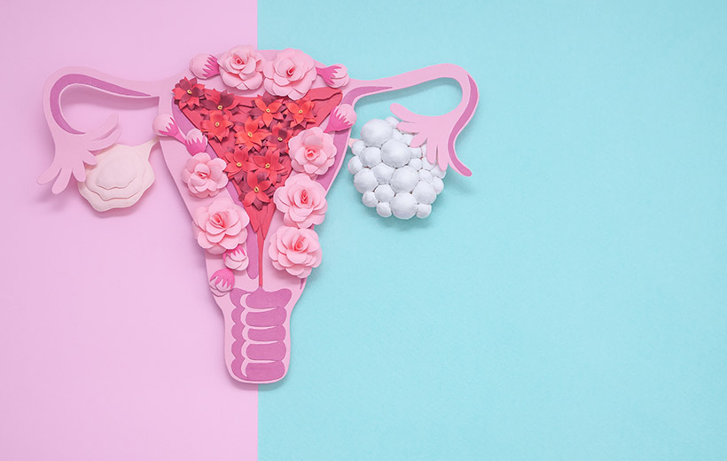 Рак яичников: стадии, симптомы, лечение, прогноз