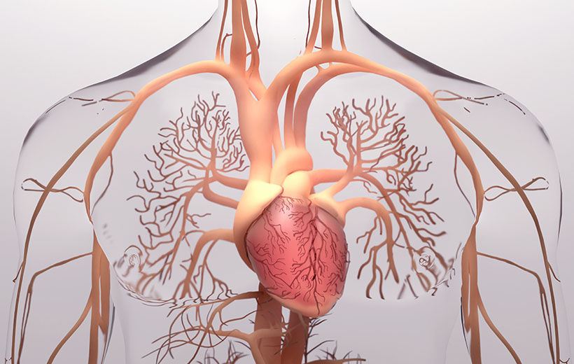 Коарктация аорты: причины, симптомы, лечение