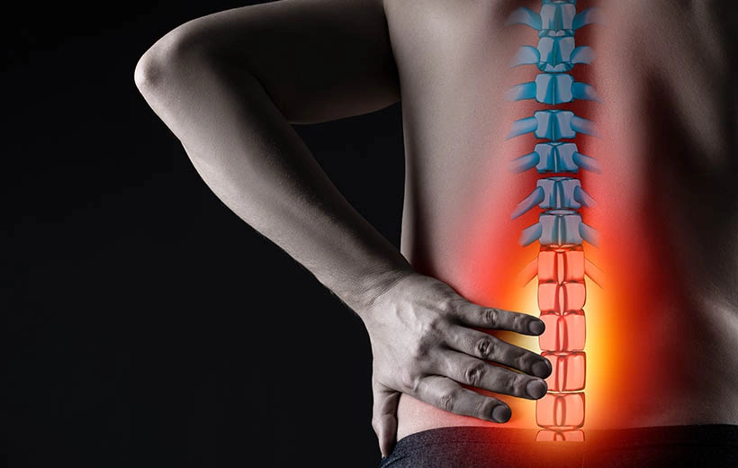 Компрессионный перелом позвоночника: симптомы, последствия, лечение