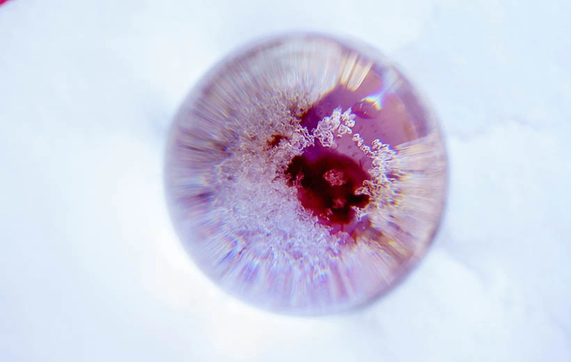 Сибирская язва: как передается, симптомы, лечение