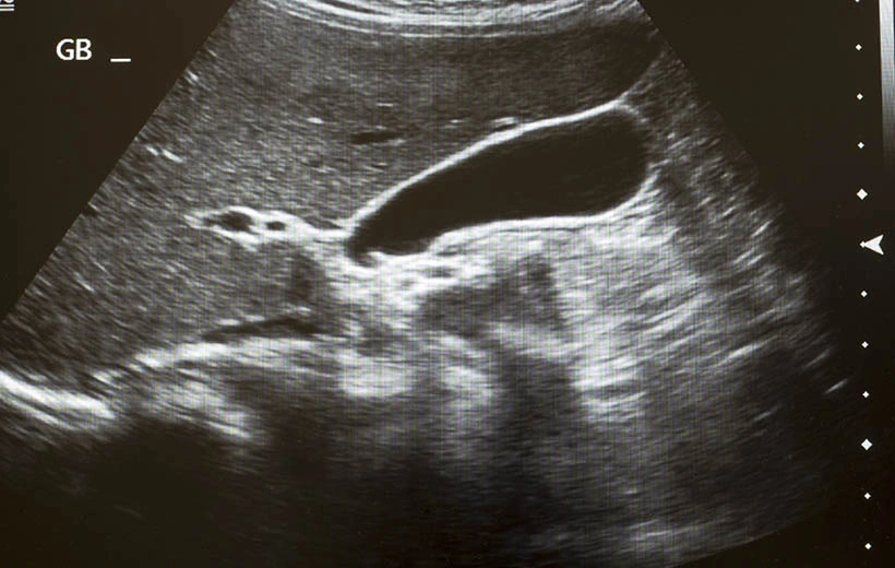 Анэмбриония: причины, симптомы, последствия