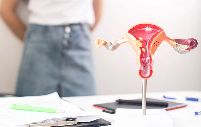 Дисфункция яичников: симптомы и лечение