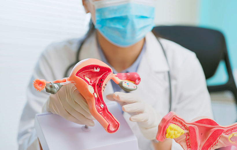 Ановуляторный цикл: причины, симптомы, лечение