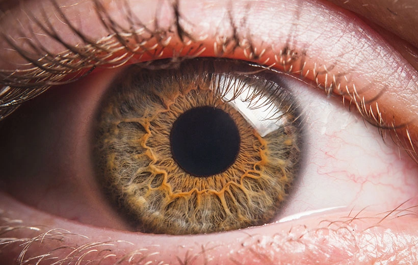 Бельмо на глазу: причины и лечение Бельмо на глазу: причины и лечение